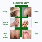 Psoriasis Cream Intensive Therapy - Image 4