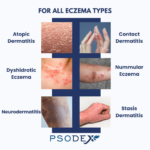 Eczema Therapy Cream - Image 5
