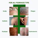 Psoriasis Cream Intensive Therapy PLUS + - Image 6