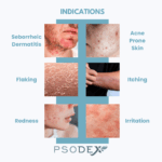 Seborrheic Dermatitis Therapy Cream - Image 4